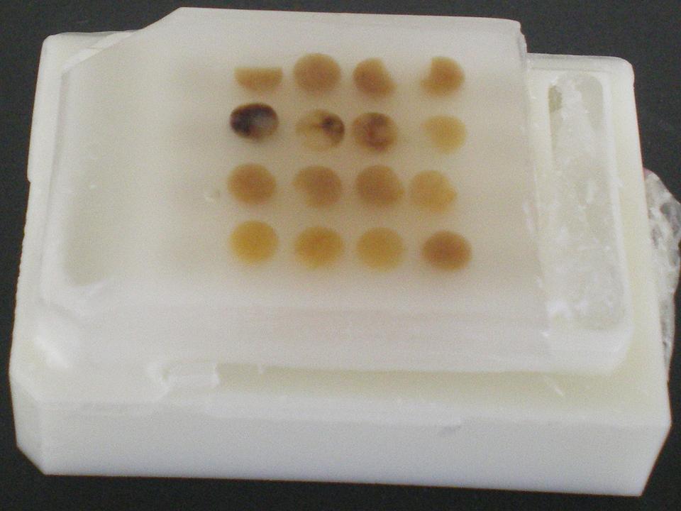 tissue microarray