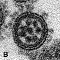 図９：インフルエンザウイルスの電子顕微鏡像（BはAの拡大図）