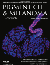 Pigment Cell & Melanoma research, 27(6):1039-1050, 2014