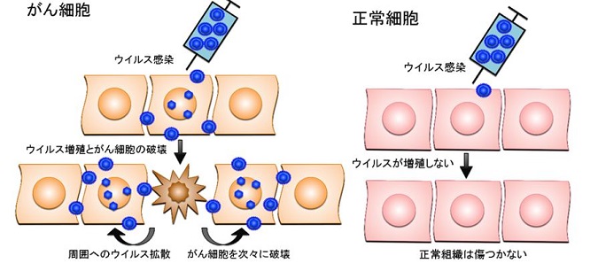 がん治療用ヘルペスウイルスg47dの実用化へ最終段階 世界初の脳腫瘍に対するウイルス療法製品 東京大学医科学研究所
