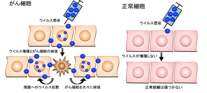 原因 ヘルペス ストレス なる に