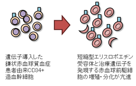 鎌状赤血球貧血の出生前検査の結果は何を意味しますか?