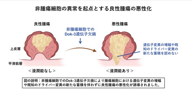 脳腫瘍について医師に尋ねるべき質問