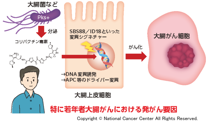 国際共同研究により大腸がんの全ゲノム解析を実施し日本人症例を解析